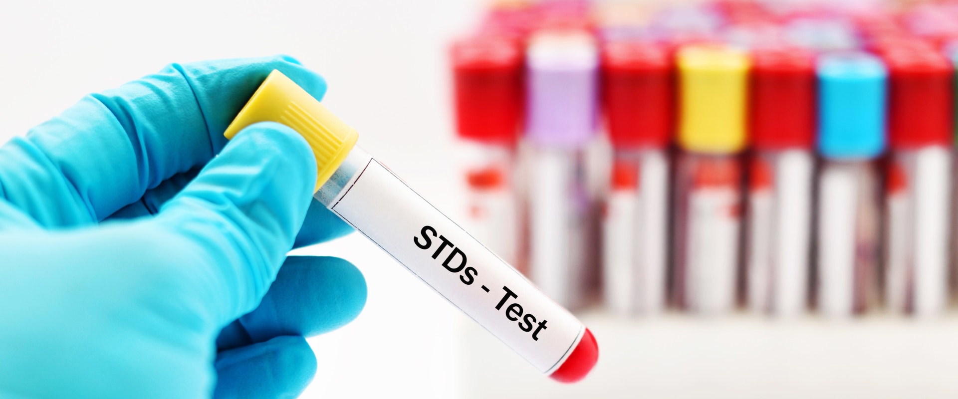 When sti testing?