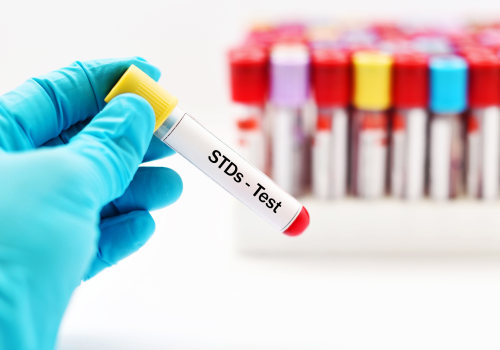 When Should I Get Tested for STDs?